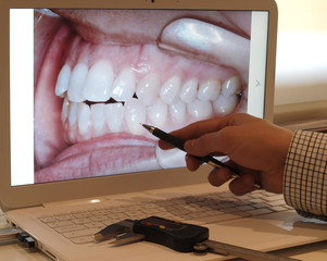 Dentist  study panoramic picture of human teeth at computer