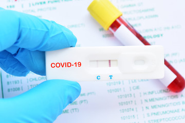 Positive test result by using rapid test device for COVID-19, novel coronavirus 2019 found in...