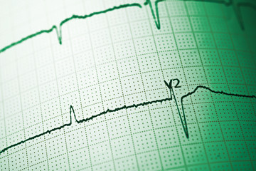 Electrocardiograph close up