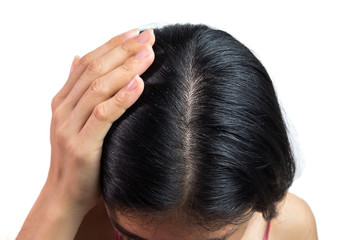 Fototapeta premium women head with dandruff Caused by the problem of dirty. Or caused by skin disease or Seborrheic Dermatitis. It has white scaly and it will cause itch. isolated on white background and clipping path.