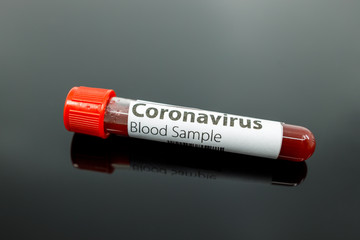 Test tube with blood sample for the new rapidly spreading Coronavirus that originated in Wuhan, China. Coronavirus blood test tube on black background with reflection and copy space