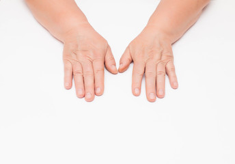 Dry skin with wrinkles on the hands of an elderly woman, white background, isolate. Fragility of blood vessels, vitamin deficiency, copy space