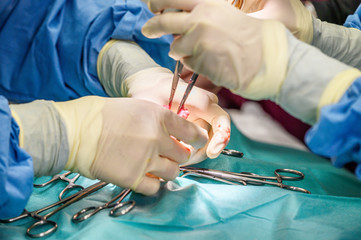 Close-up, Hands of the Professional Surgeon, doing surgery. In the Background Modern Hospital Operation Room .
