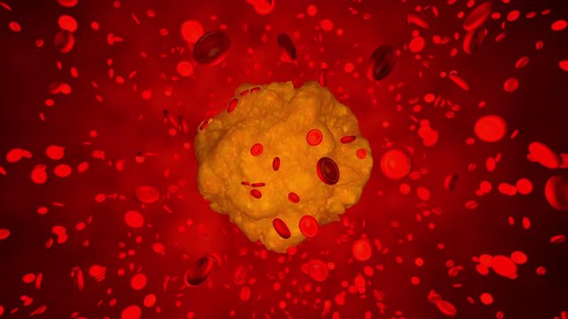3D rendered animation of a cancel cell or Leukemia cell in the Bloodstream.