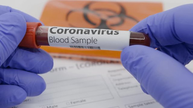 Microbiologist hand with blue surgical gloves showing a blood test tube for the new rapidly spreading Coronavirus. Blood test request form and biohazard transportation back in the background