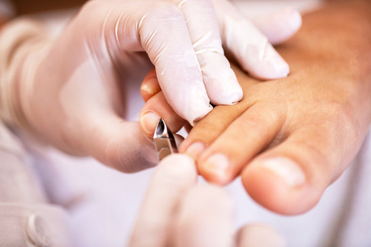 Cuticle treatment, concept of pedicure