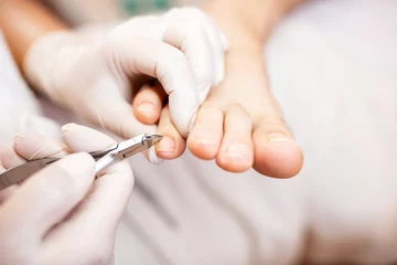 Foto op Canvas Pedicure nagelbehandeling voor gezond uitziende teennagels © didesign