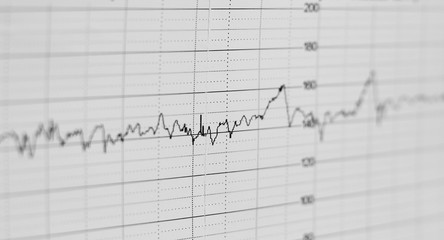 ecg graph, electrocardiogram ekg on paper