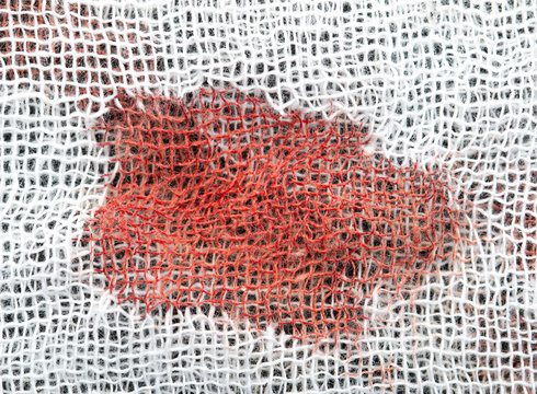 red spot on white material