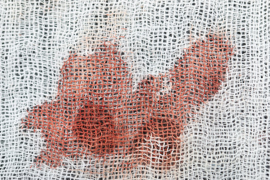 red spot on white material