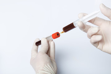 Doctor's hand with medical gloves handling a blood probe 
