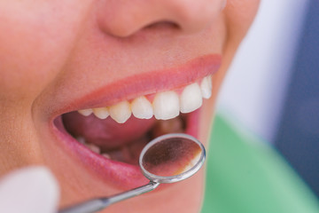 Closeup of a female patient with an open mouth during oral checkup at the dentist.