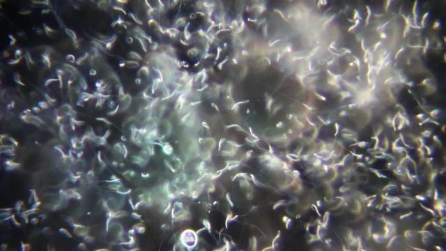 The study of chicken sperm under the microscope view in laboratory.