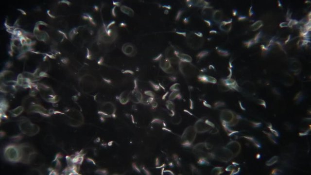 The study of chicken sperm under the microscope view in laboratory.