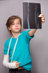 Naklejka premium Sad handsome boy with broken arm holding his z -ray image, looking on broken bones