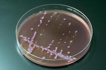bacterial colonies   on  agar   medium petri dish plate plate on MacConkey agar