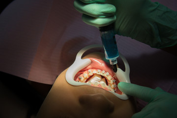 Dentist Appointment Orthodontics Teeth Treatment