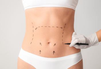 Fototapeta na wymiar Plastic surgeon applying marks on female body against light background
