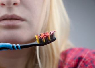 Toothbrush with blood closeup. A woman discovered bleeding gums while brushing her teeth....