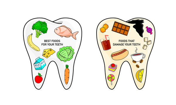 Best foods and bad Foods for your teeth. Dental care concept. Vector illustration in flat design. Collection of Foods placed on abstract tooth shape.
