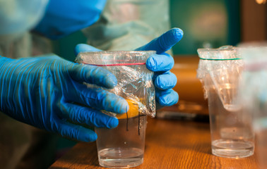 A scientist looks at a chicken yolk in a transparent cup.