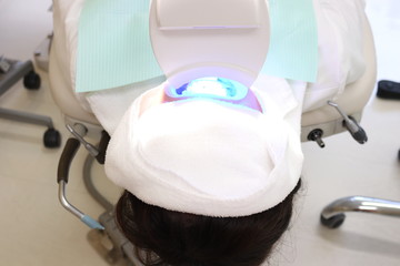 ホワイトニング