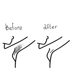 Before and after transformation process. Woman beauty procedures, shaving of armpits, laser hair removal. Vector stock illustration in doodle style.