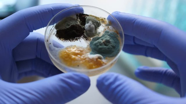 Scientist analyse in bacteria culture. Closeup. Petri dish with Bacteria in chemical lab. Hand in blue glove holds petri dish with mold and bacterium colony. Science professional grafting bacteria.