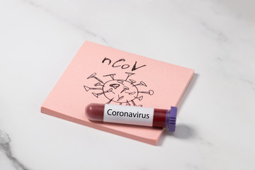 test tube with blood for 2019-nCoV analyzing. Chinese Coronavirus blood test Concept