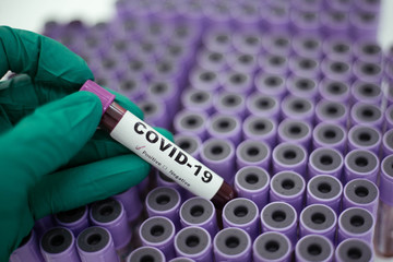 Fototapeta premium laboratory technician hand hold on blood sample tube for corona virus test , COVID 19 test 