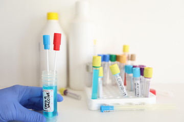 covid-19 coronavirus vaccine research - medical biotechnology laboratory