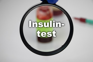 A blood sample for a test for insulin. The doctor’s hand holds a magnifying glass in which a test...