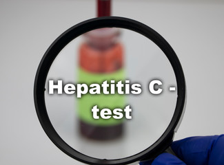 A blood sample for a test for Hepatitis C. The doctor’s hand holds a magnifying glass in which a...