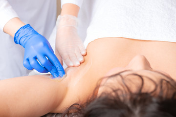 Fototapeta premium Armpit epilation, sugaring or waxing hair removal.