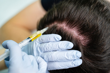 Injection plasma into head hair man cosmetologist doctor
