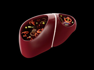 3d Rendering of Liver Infection with bacterias and viruses