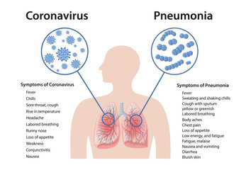 Differences between symptoms of pneumonia and coronavirus. Pneumonia symptoms. Symptoms of 2019-nCoV. Vector illustration in flat style isolated over white background