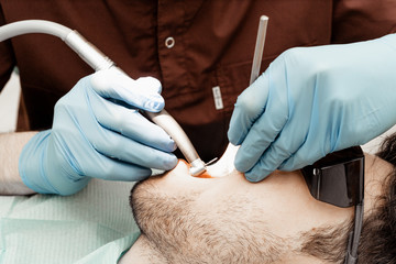 A young male dentist doctor treats a patient. Medical manipulations in dentistry, surgery....
