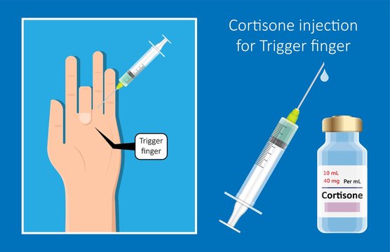 Cortisone Shots Injection Epidural Steroid ESI Lumbar Back Spinal Nerves Anti Inflammatory Carpal Tunnel Syndrome Tennis Elbow Symptom Swelling Chronic Discomfort