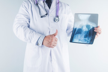 Doctor examining chest x-ray film of patient at hospital.