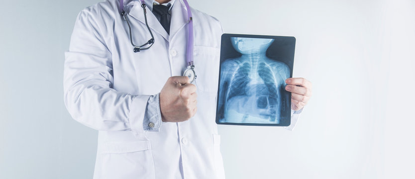 Doctor examining chest x-ray film of patient at hospital.