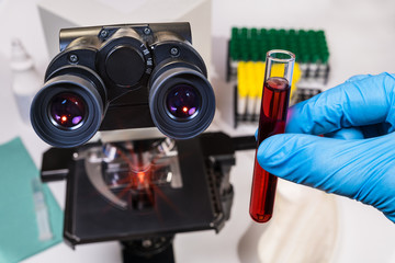 Laboratory optical microscope. Diagnostic test tube in hand with blue glove. Doctor analyzing...