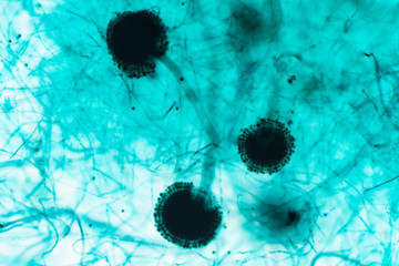 Aspergillus (mold) under microscopic view for education.