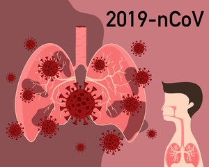 Covid-19 coronavirus spreading in human lung.