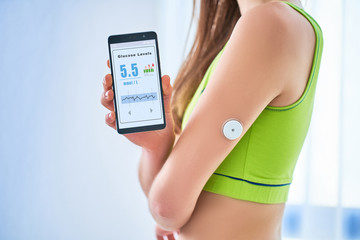 Woman diabetics control and checking glucose level with a remote sensor and mobile phone. Continuous online monitoring glucose levels without blood. Digital medical technology in diabetes treatment - obrazy, fototapety, plakaty
