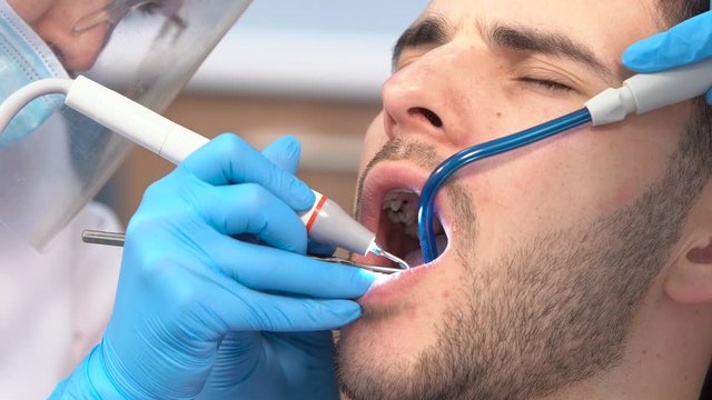 close-up of the face of a young bearded man with his mouth wide open while sitting in the dental chair while the dentist in medical gloves and a protective mask is working with the patient&rsquo;s teeth.