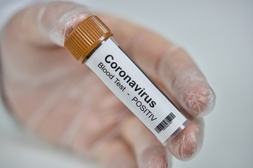 2019-nCoV Coronavirus. Positive blood sample held in one hand with laboratory glove. Respiratory...