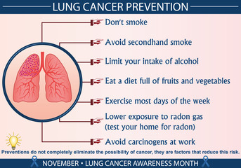 Lung cancer prevention infographic vector illustration. Health, healthcare, and november lung cancer awareness month concept for presentation, brochure, banner etc. Eps 10 format with printable colors