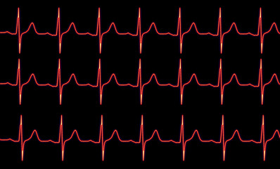 Red cardiogram pulse trace on black background, cardiovascular medical exam. Healthy heart concept....