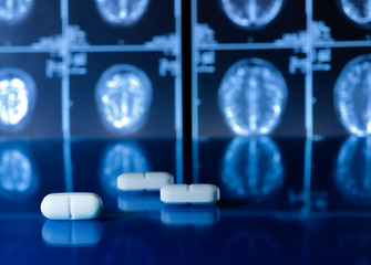 three white medical pills on a brain MRI scan background
